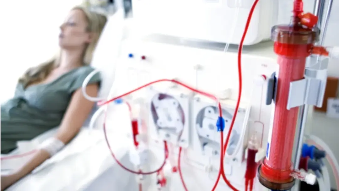 hemodialysis (2)